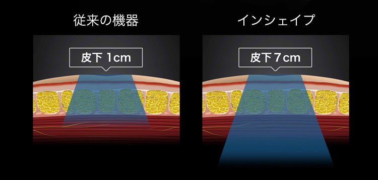 従来機よりも奥まで届く
